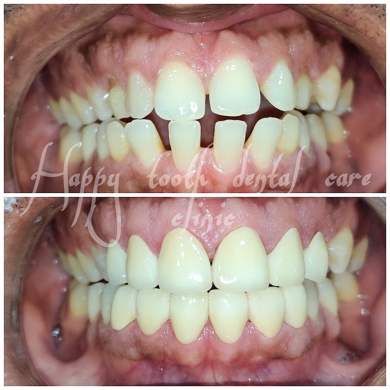 Case 01 — selected dental treatment result